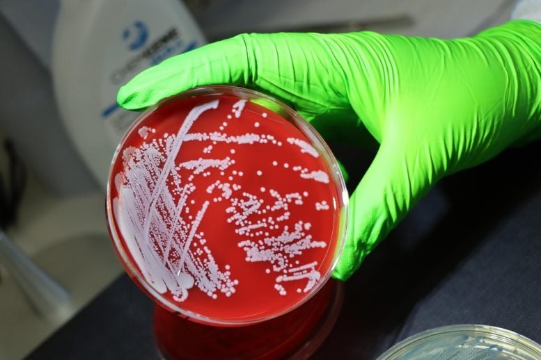 Genetic Breakthrough Reveals How Superbugs Outsmart Our Defenses